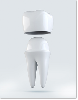 Dental Crown & Bridges Services By Oasis Dental in Rancho Cucamonga, California